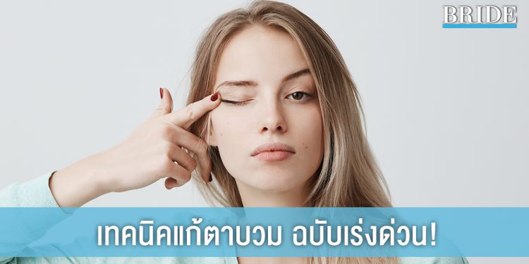 ร้องไห้หนักแค่ไหนก็ไม่หวั่น! กับ 5 เทคนิค แก้ตาบวมฉบับเร่งด่วน