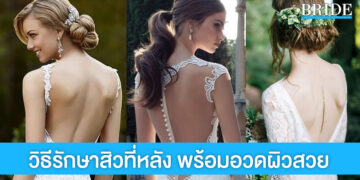 5 วิธีช่วยรักษาสิวที่หลัง เพื่อความปังวันวิวาห์
